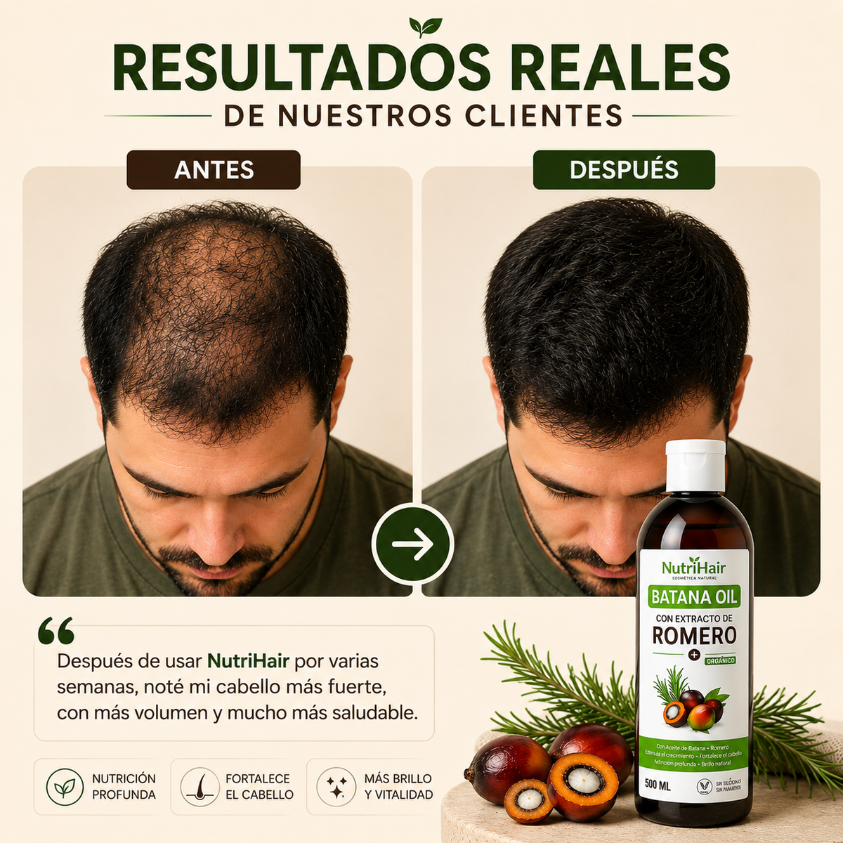 NutriHair™ - Con extracto de Romero