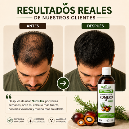NutriHair™ - Con extracto de Romero